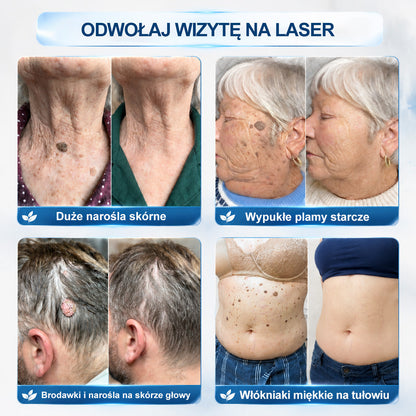 Oficjalny sklep markowy |💖Hiskin® 7 𝑫𝒏𝒊 𝑷𝒓𝒆𝒑𝒂𝒓𝒂𝒕 𝑫𝒐 𝑼𝒔𝒖𝒘𝒂𝒏𝒊𝒂 𝑾łó𝒌𝒏𝒊𝒂𝒌ó𝒘 𝑴𝒊ę𝒌𝒌𝒊𝒄𝒉 𝑰 𝑷𝒓𝒛𝒆𝒃𝒂𝒓𝒘𝒊𝒆ń(𝐁𝐞𝐳 𝐁ó𝐥𝐮, 𝐁𝐞𝐳 𝐁𝐥𝐢𝐳𝐧 – 𝐑𝐨𝐥𝐥-𝐨𝐧)
